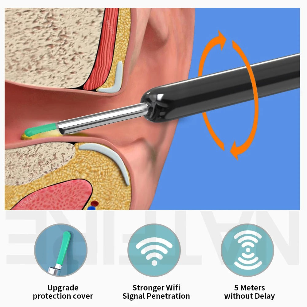 Smart Visual Ear Cleaner - Essence Home N Wellness